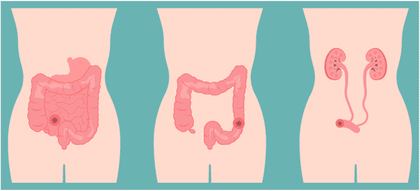 Manejo Avanzado Especializado